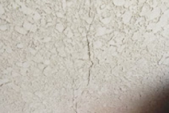 ひび割れ（クラック）